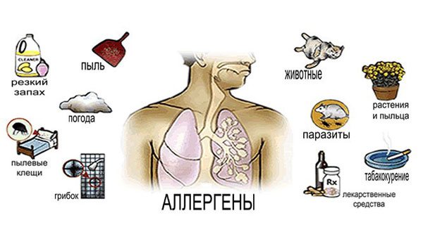 Аллергены - причина развития бронхиальной астмы