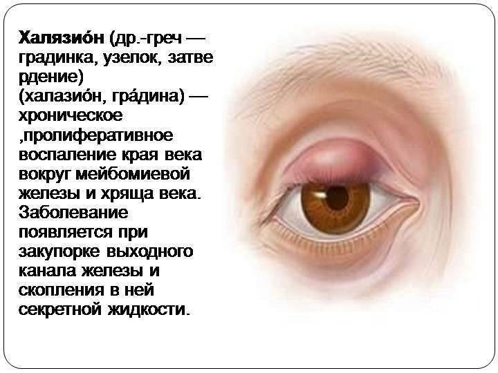 Аллергический отек глаз: причины, сопутствующие симптомы (веки чешутся, опухают), фото, отек квинке, что делать и как лечить отечность