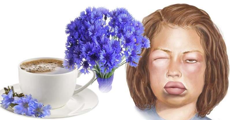 Аллергия на цикорий: основные признаки