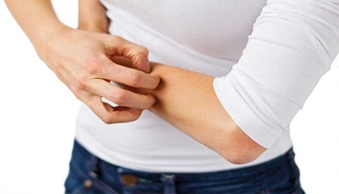 Аллергия на груди и под грудью: причины, симптомы, лечение