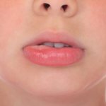 Аллергия на губах у взрослых и детей: симптомы