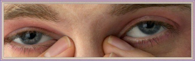 Аллергия на веках глаз и пути лечения