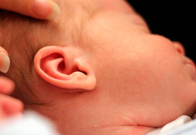 Atopic dermatitis photo in adults behind the ears