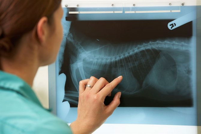 Диагностика: осмотр, рентген и бронхоскопия