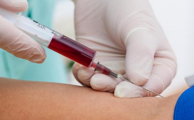 Еще более показательным в плане определения аллергенов является иммунологический анализ крови.
