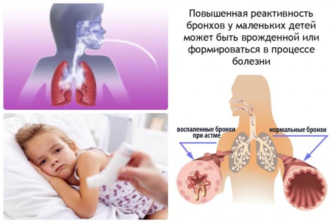Факты об астме у детей