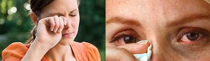 может ли быть аллергия на контактные линзы