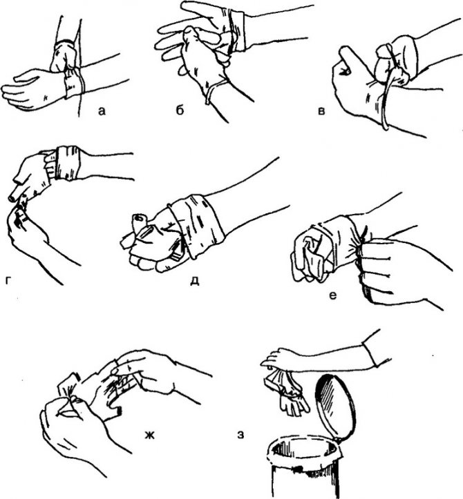 Отвечаем на часто задаваемые вопросы по медицинским перчаткам., изображение №9
