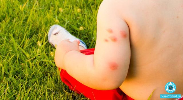 redness and swelling in children