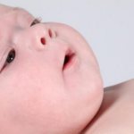 Потничка у новорожденных детей: причины и рекомендации как и чем лечить