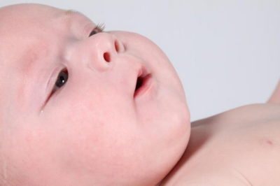 Потничка у новорожденных детей: причины и рекомендации как и чем лечить