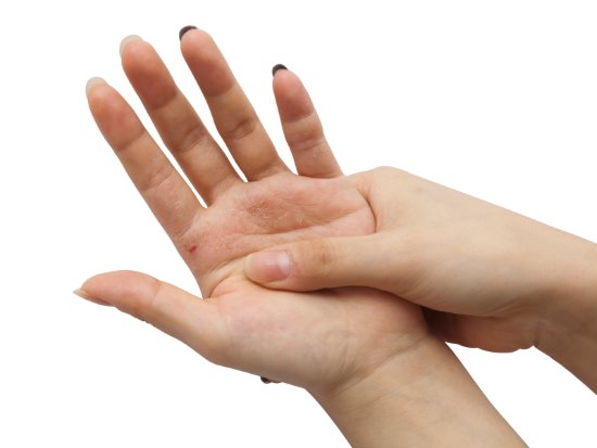 Причины и лечение кожи, если чешутся ладони рук. Возможные заболевания и аллергия