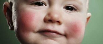 Виды аллергии у малышей до 1 года