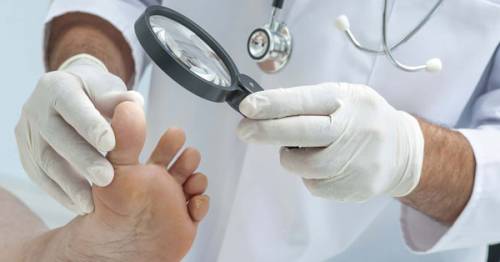 Doctor examining toes